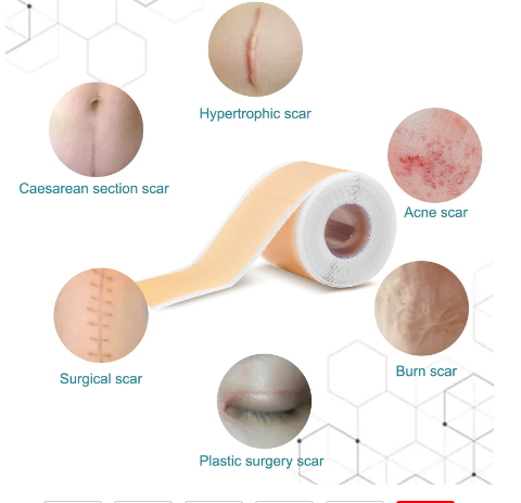 How to Remove Chronic Body Scars Permanently at Home in Uganda, everything you need to know